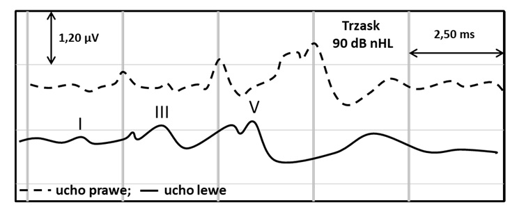 Rycina 1 do tego pytania