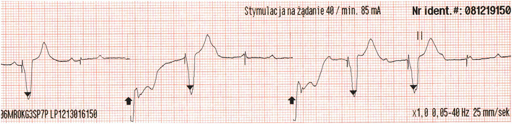 Rycina 1 do tego pytania